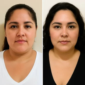 Masajeador Facial - GlowLift