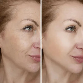Masajeador Facial - GlowLift